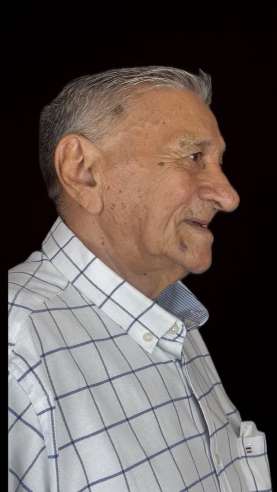 Paciente antes do implante dentário — perfil