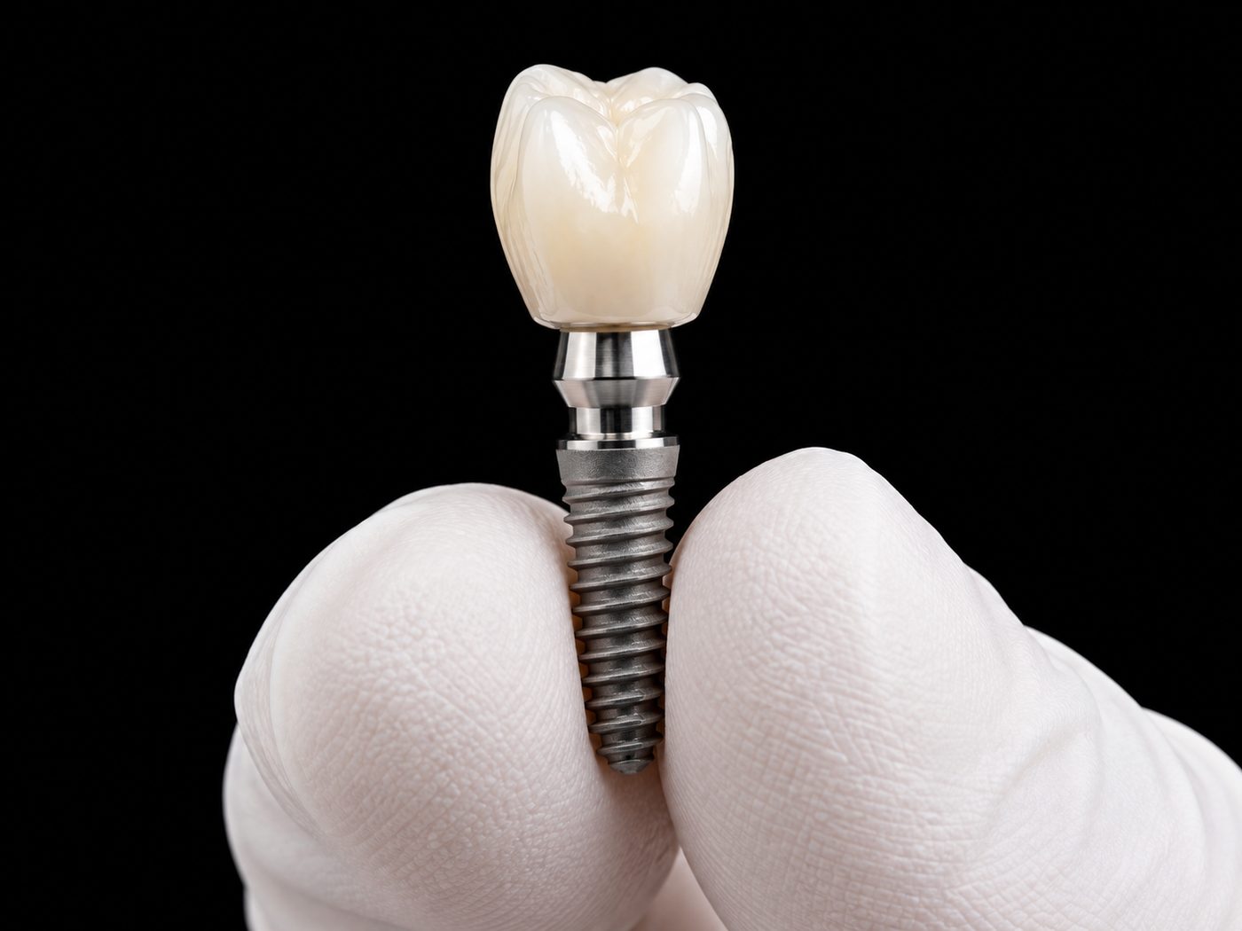 Implante Imediato — Eydental